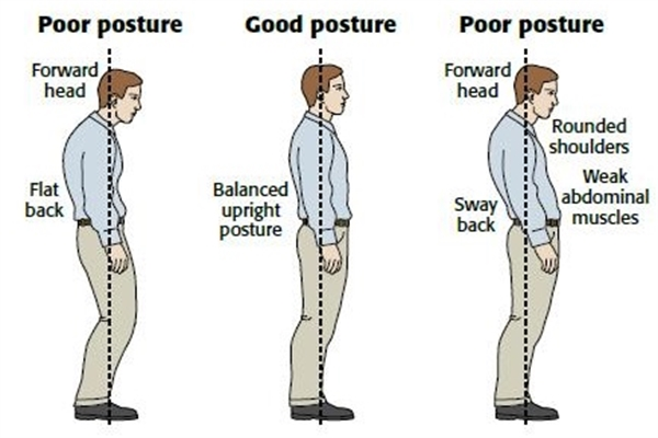 Can Posture Correctors Really Improve Our Posture?