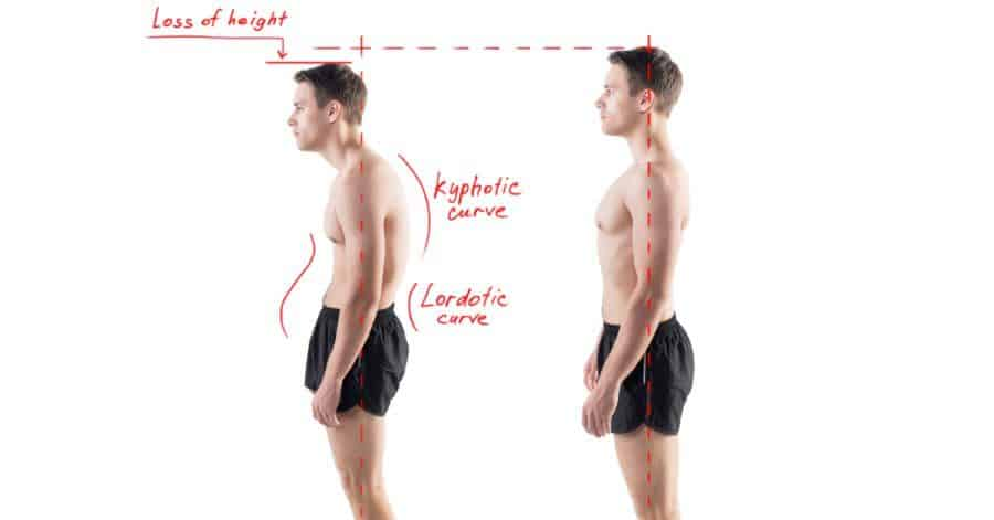 Do posture correctors work?