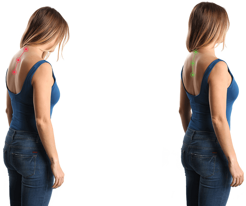 Can a posture corrector improve my poor posture?