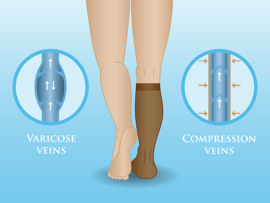 The benefits of compression stockings for nurses