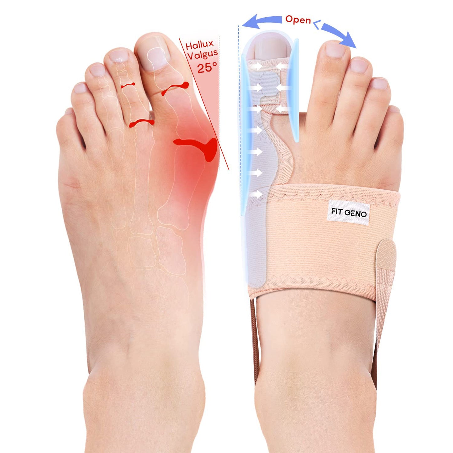 Adjustable big toe corrector brace with open wrap design on white background